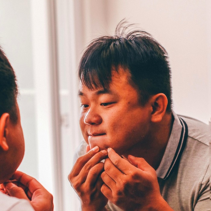 인중 여드름 원인