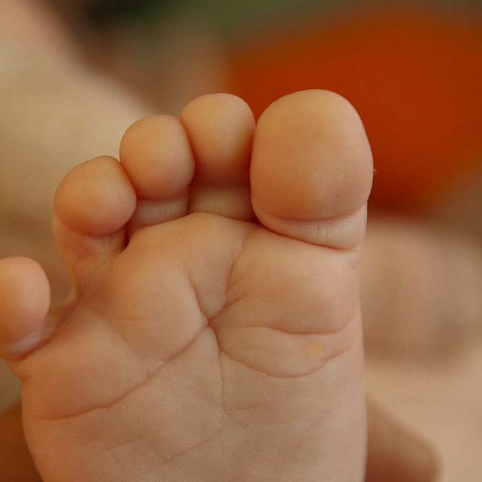 아기 발가락 증상