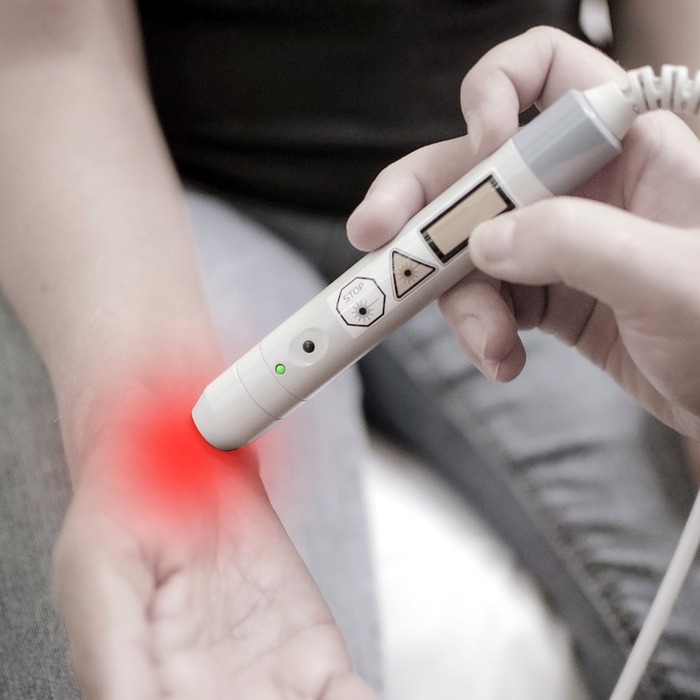 근막통증 증후군